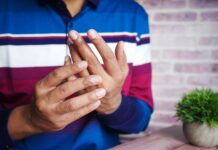 Clubbed Thumb Surgery: Is It Possible? Clubbed Thumb Surgery: Is It Possible?