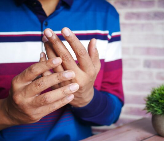Clubbed Thumb Surgery: Is It Possible? Clubbed Thumb Surgery: Is It Possible?